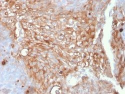 Uroplakin Ia Antibody (UPK1A/2925) - Azide and BSA Free, Novus Biologicals