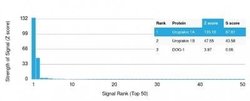 Uroplakin Ia Antibody (UPK1A/2925) - Azide and BSA Free, Novus Biologicals