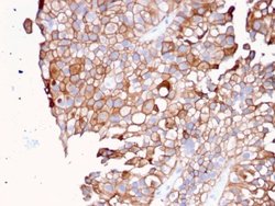 Uroplakin Ib, Mouse anti-Human, Clone: UPK1B/3081, Novus Biologicals:Antibodies:Primary