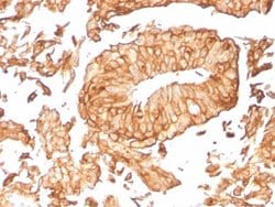 Uroplakin Ib, Mouse anti-Human, Clone: UPK1B/3081, Novus Biologicals:Antibodies:Primary