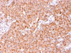 Uroplakin Ib, Mouse anti-Human, Clone: UPK1B/3081, Novus Biologicals:Antibodies:Primary