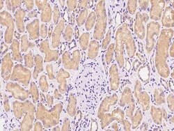 Use1/UBE2Z Antibody, Novus Biologicals 100 &mu;g | Buy Online | Novus Biologicals | Fisher Scientific