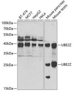 Use1/UBE2Z Antibody - BSA Free, Novus Biologicals 0.02 mL | Buy Online | Novus Biologicals | Fisher Scientific