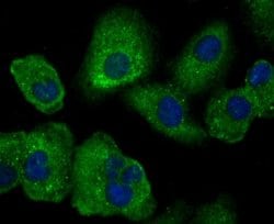 Uteroglobin/SCGB1A1 Antibody (JU34-03), Novus Biologicals 100 &mu;l; Unconjugated:Antibodies,