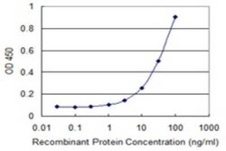 Uteroglobin/SCGB1A1 Antibody (1F7), Novus Biologicals 0.1 mg, Unconjugated:Antibodies,