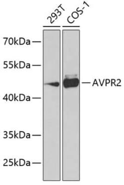 V2 Vasopressin R/AVPR2 Antibody - BSA Free, Novus Biologicals 0.02 mL,