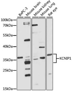 VABP Antibody - Azide and BSA Free, Novus Biologicals 0.1 mL, Unconjugated:Antikörper