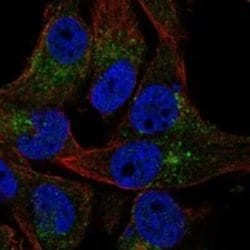 VAC14 Rabbit anti-Human, Polyclonal, Novus Biologicals 100 &mu;g | Buy Online | Novus Biologicals | Fisher Scientific