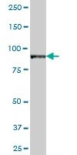 VAC14 Antibody, Novus Biologicals 0.05 mg | Buy Online | Novus Biologicals | Fisher Scientific