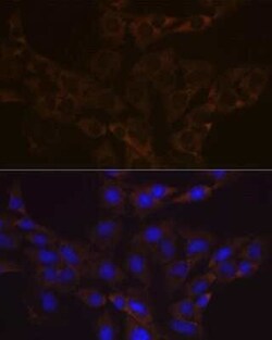 VAMP-1 Rabbit anti-Human, Mouse, Rat, Clone: 1A3K6, Novus Biologicals 100