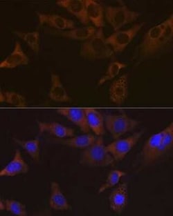 VAMP-1 Rabbit anti-Human, Mouse, Rat, Clone: 1A3K6, Novus Biologicals 100