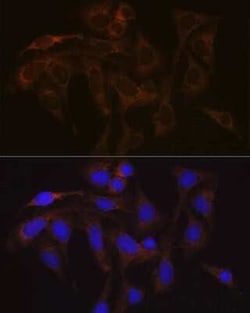 VAMP-1 Rabbit anti-Human, Mouse, Rat, Clone: 1A3K6, Novus Biologicals 100