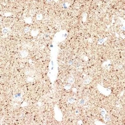 VAMP-1 Rabbit anti-Human, Mouse, Rat, Clone: 1A3K6, Novus Biologicals 100