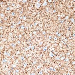 VAMP-1 Rabbit anti-Human, Mouse, Rat, Clone: 1A3K6, Novus Biologicals 100