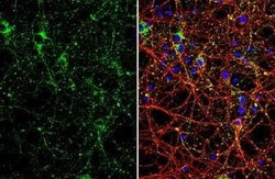 VAMP-2 Antibody (GT766), Novus Biologicals 100 &mu;g | Buy Online | Bio-Techne | Fisher Scientific