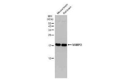 VAMP-2 Antibody (GT766), Novus Biologicals 100 &mu;g | Buy Online | Bio-Techne | Fisher Scientific