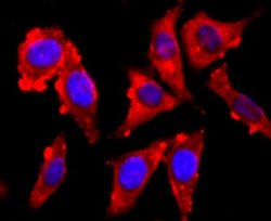 VAMP-2 Rabbit anti-Human, Clone: JM11-00, Novus Biologicals 100&mu;L:Antibodies,