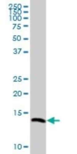 VAMP-8 Antibody, Novus Biologicals 0.05 mg | Buy Online | Novus Biologicals | Fisher Scientific