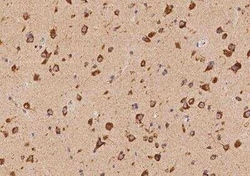 VAMP4 Antibody, Novus Biologicals:Antibodies:Primary Antibodies