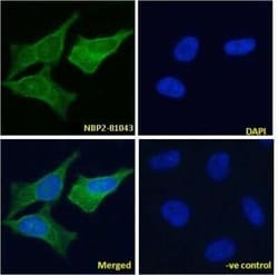 VAP-1/AOC3, Rabbit anti-Human, Clone: TK8-14, Novus Biologicals 0.025 mg;