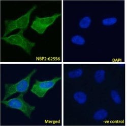 VAP-1/AOC3 Antibody (TK8-14) - Azide and BSA Free, Novus Biologicals 0.025