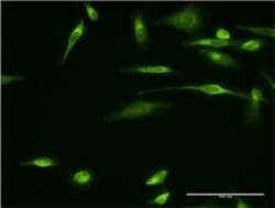 VAP-A Antibody (4C12), Novus Biologicals 0.1 mg; Unconjugated:Antibodies,