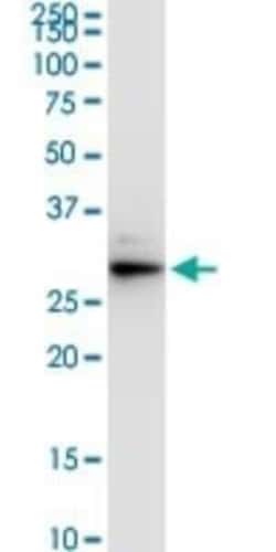 VAP-A Antibody (4C12), Novus Biologicals 0.1 mg; Unconjugated:Antibodies,