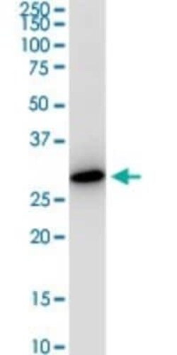 VAP-A Antibody (4C12), Novus Biologicals 0.1 mg; Unconjugated:Antibodies,