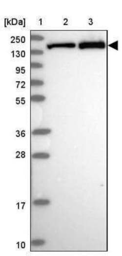 VARS Antibody, Novus Biologicals 25 &mu;L | Buy Online | Novus Biologicals | Fisher Scientific