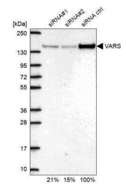 VARS Antibody, Novus Biologicals 25 &mu;L | Buy Online | Novus Biologicals | Fisher Scientific