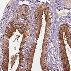 VARS2 Antibody, Novus Biologicals 0.1 mL | Buy Online | Novus Biologicals | Fisher Scientific