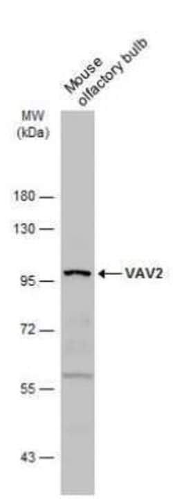 VAV2 Antibody, Novus Biologicals 100 &mu;g; Unconjugated:Antibodies, Polyclonal