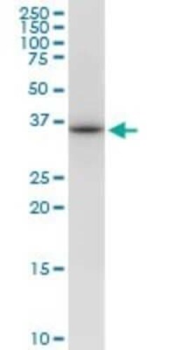 VAX1 Antibody (2F4), Novus Biologicals 0.1 mg | Buy Online | Novus Biologicals | Fisher Scientific