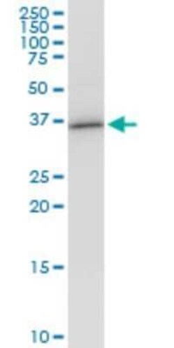 VAX1 Antibody (2F4), Novus Biologicals 0.1 mg | Buy Online | Novus Biologicals | Fisher Scientific