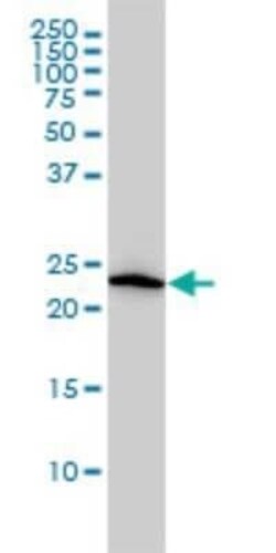 VBP1 Antibody (3D11), Novus Biologicals 0.1 mg | Buy Online | Novus Biologicals | Fisher Scientific