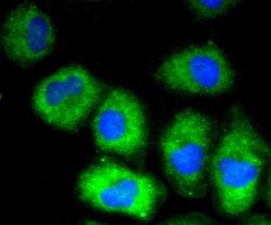 VCAM-1/CD106 Antibody (SA05-04), Novus Biologicals 100&mu;L:Antibodies,