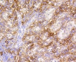 VCAM-1/CD106 Antibody (SA05-04), Novus Biologicals 100&mu;L:Antibodies,