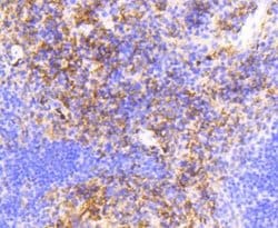 VCAM-1/CD106 Antibody (SA05-04), Novus Biologicals 100&mu;L:Antibodies,