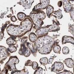 VCIP135/VCPIP1 Antibody, Novus Biologicals:Antibodies:Primary Antibodies