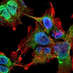 VDAC1 Antibody (S152B-23), Novus Biologicals 0.025 mg; Unconjugated:Antibodies,