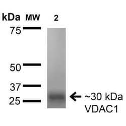 VDAC1 Antibody (S152B-23), Novus Biologicals 0.025 mg; Unconjugated:Antibodies,