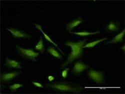 VDAC2 Antibody (3D2), Novus Biologicals 0.1 mg | Buy Online | Novus Biologicals | Fisher Scientific
