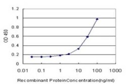 VDR/NR1I1/Vitamin D Receptor Antibody (2F4), Novus Biologicals 0.1 mg | Buy Online | Novus Biologicals | Fisher Scientific