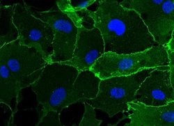 VE-Cadherin Rabbit anti-Human, Clone: 48, Novus Biologicals:Antibodies:Primary