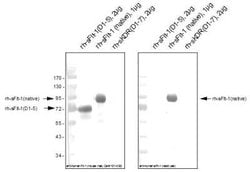 VEGFR1/Flt-1 Rabbit anti-Human, Polyclonal, Novus Biologicals 0.02 mg;