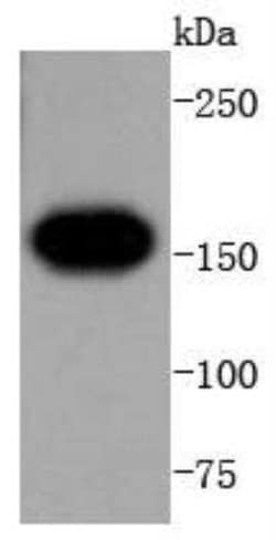 VEGFR1/Flt-1 Antibody (SY09-09), Novus Biologicals:Antibodies:Primary Antibodies