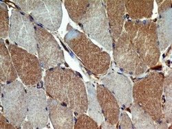 VEGFR2/KDR/Flk-1 Antibody (2C6) - Azide and BSA Free, Novus Biologicals