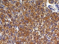 VEGFR2/KDR/Flk-1 Antibody (2C6) - Azide and BSA Free, Novus Biologicals