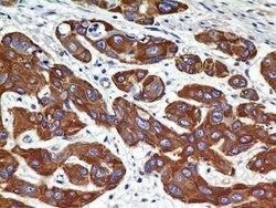 VEGFR2/KDR/Flk-1 Antibody (2C6) - Azide and BSA Free, Novus Biologicals