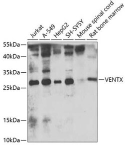 VENTX Antibody - BSA Free, Novus Biologicals 0.02 mL, Unconjugated:Anticuerpos